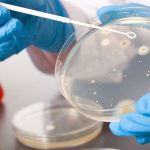 Organisasi kesehatan dunia ini menyebut bahwa penyakit ini menular lewat interaksi yang dekat.