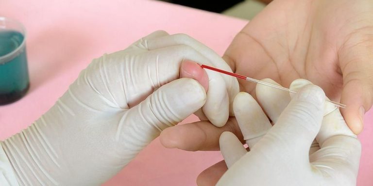 tes-golongan-darah-1580204216