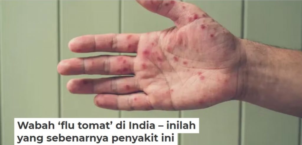 WhatsApp Image 2022-09-04 at 09.22.07